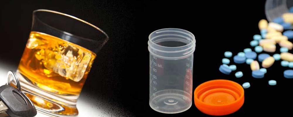 drug alcohol testing